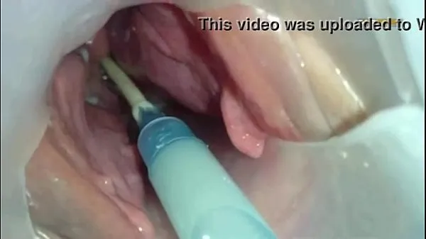 Ferske Sperm injected into the uterus of the wife of others beste videoer