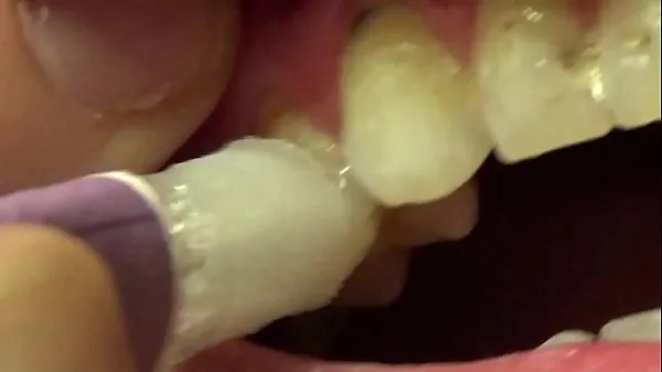 Sveži Applying Whitening Paste To Her Filthy Teeth najboljši videoposnetki
