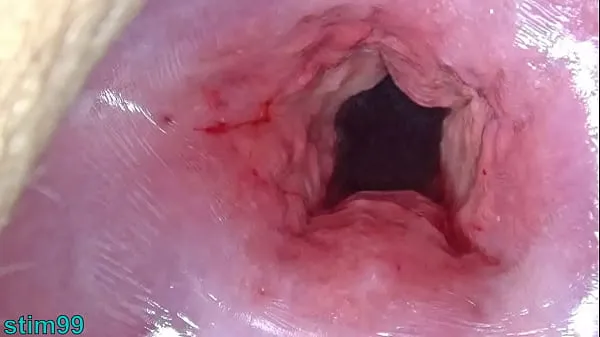 Taze Japan Mom Cervix open wide Dilatation and fucking Uterus with Insertion of huge Objects en iyi Videolar